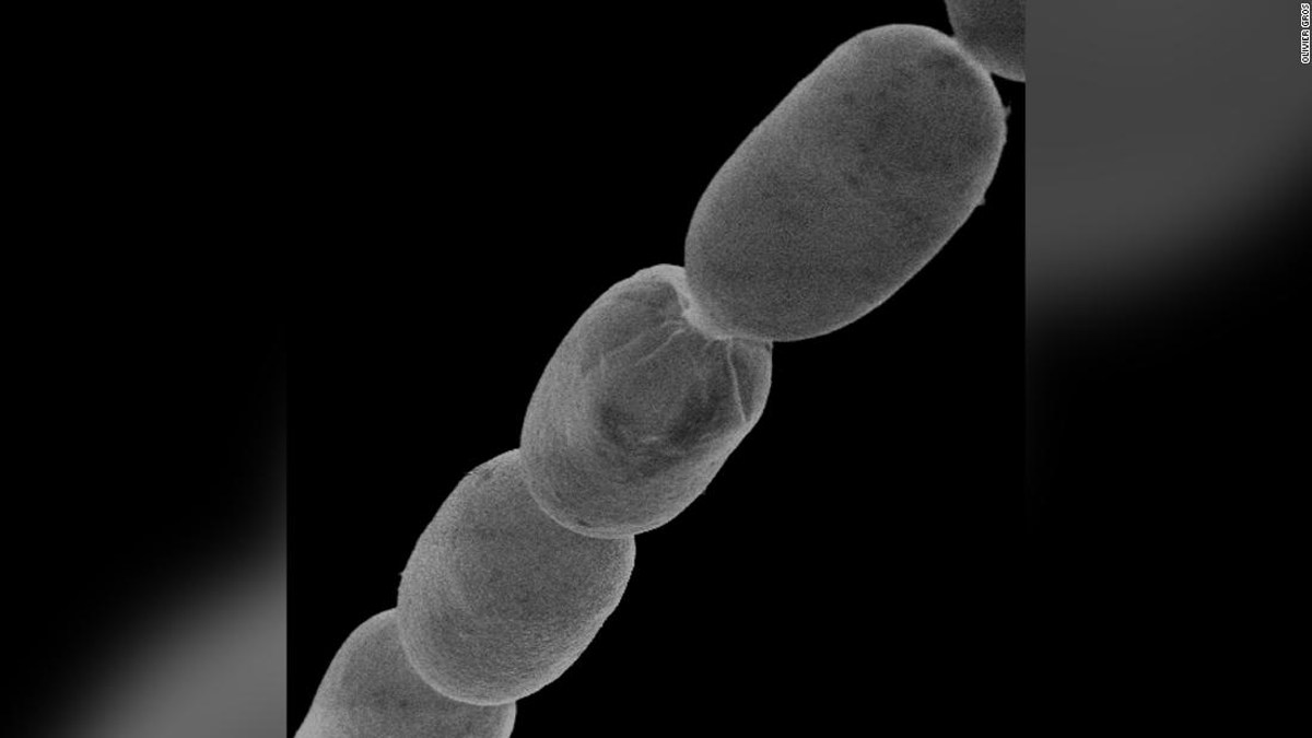 Bakteri Terbesar di Dunia Ditemukan, Ukurannya 5.000x Lebih Besar
